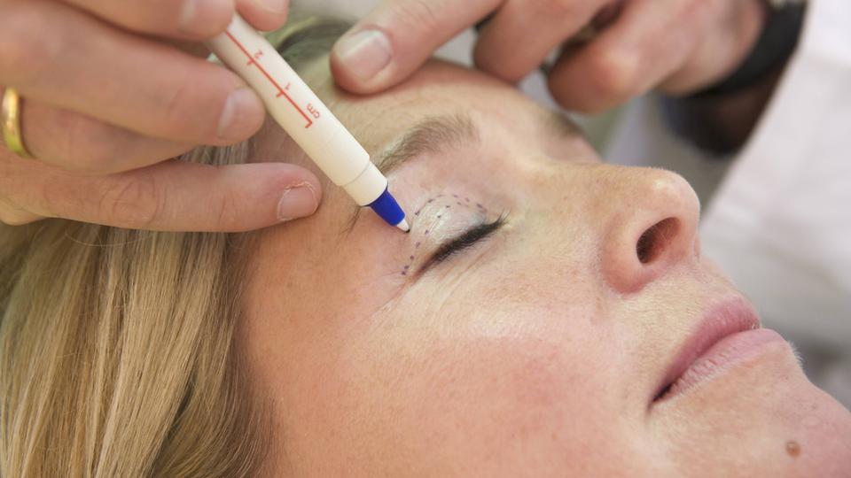 Ops Botox Schönheits OP: So viel kosten die Beauty OPs, welche Nebenwirkungen ...